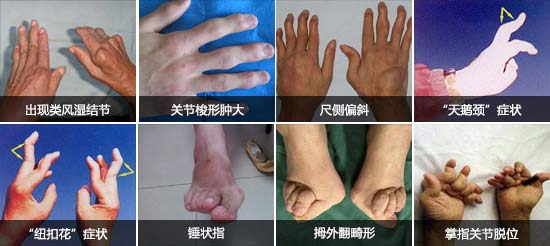 F(yng)(qing)ֱt(y)ԺL(fng)ָ_ֺȶ̎P(gun)(ji).jpg
