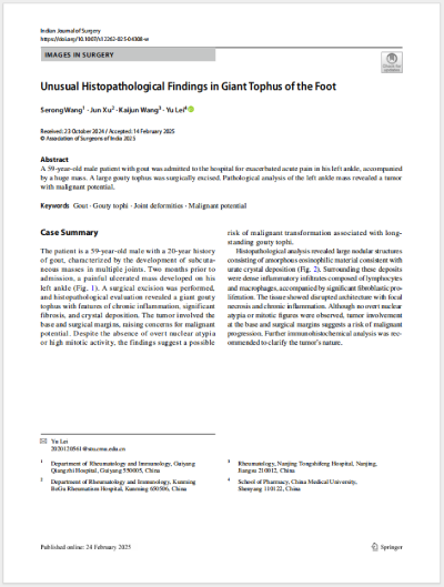 25ɫεȹͬ׫¡Unusual Histopathological Findings in Giant Tophus of the Foot㲿޴ʹL(fng)ʯĮMW(xu)F(xin)SCIڿIndian Journal of Surgeryl(f).png